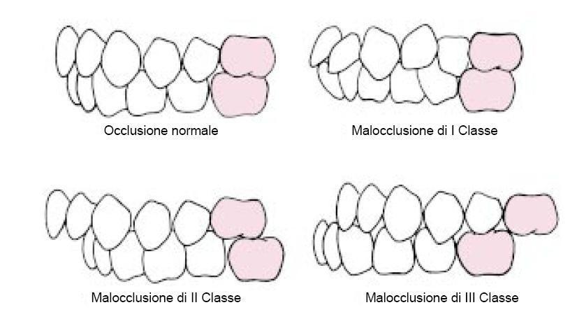 Ortodonzia 1